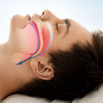 South Jersey Sleep Apnea Treatments - Normal Airway